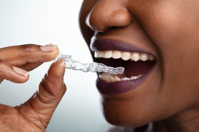 patient putting in her new Invisalign clear aligners