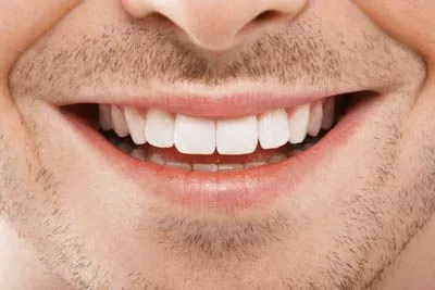 closeup of a patient's smile after a root canal